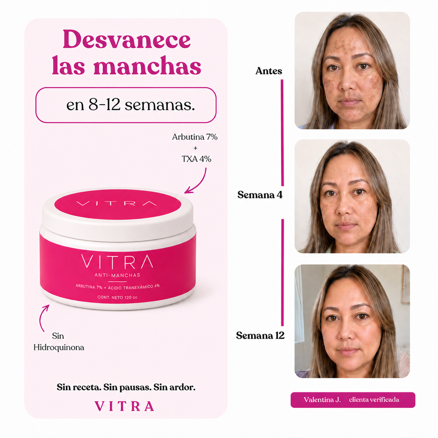 Desvanece las manchas en 8-12 semanas