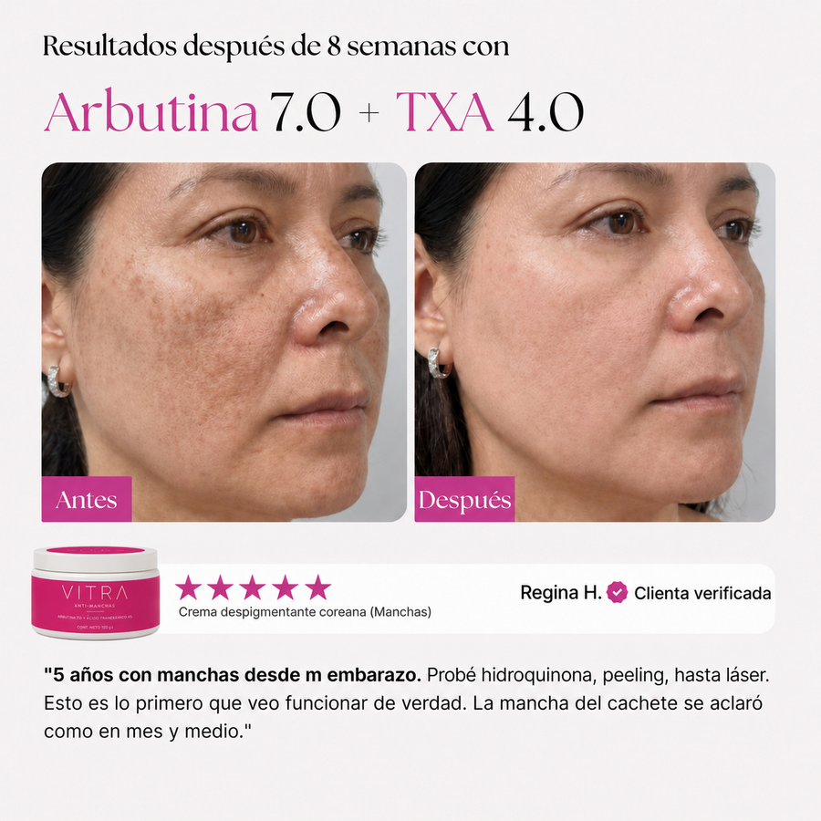 Resultados después de 8 semanas