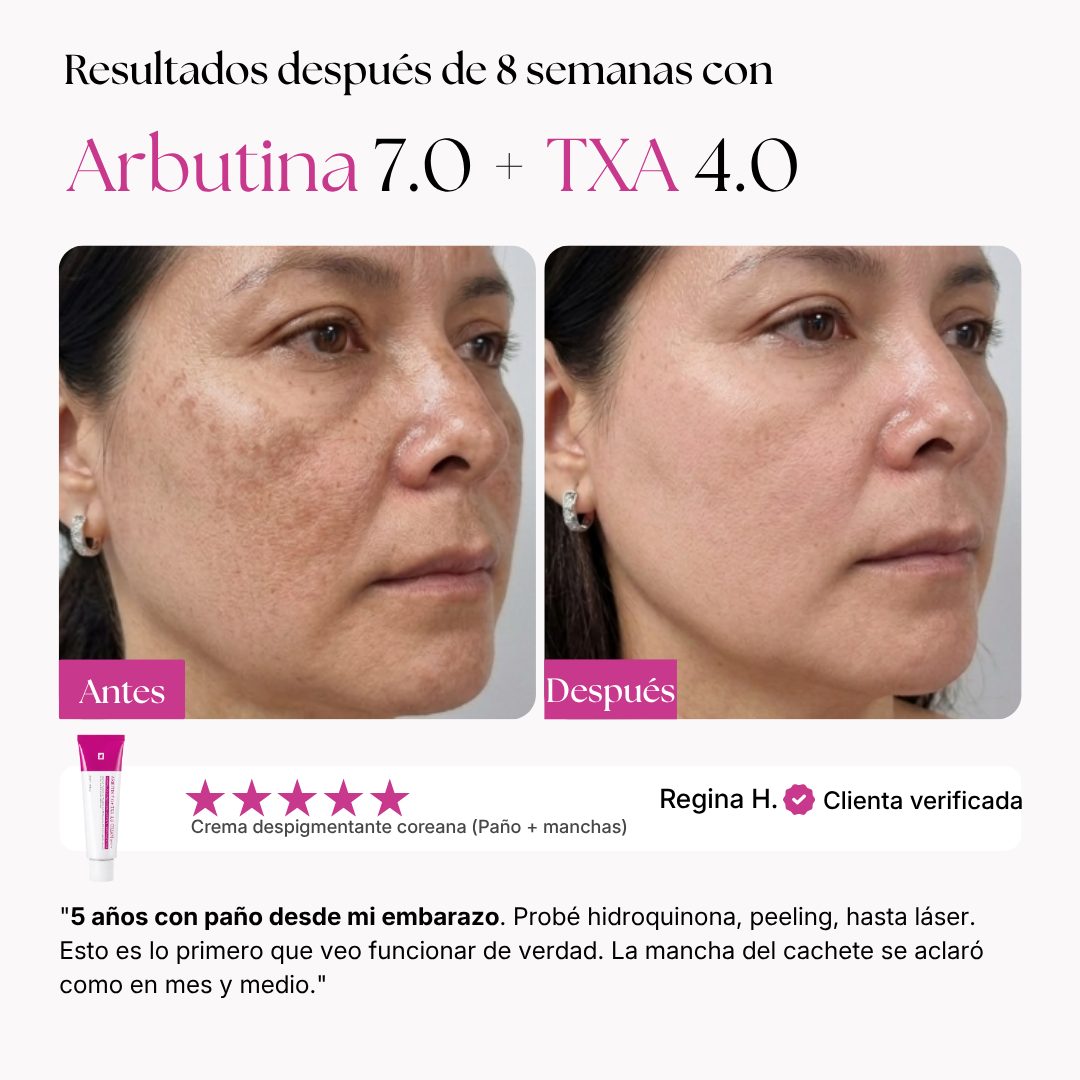 Resultados después de 8 semanas