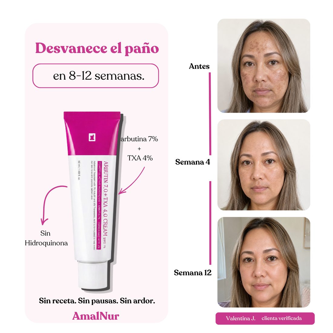 Desvanece las manchas en 8-12 semanas